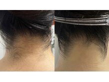 リュール(Lueur)/自信を持てる後ろ姿へ