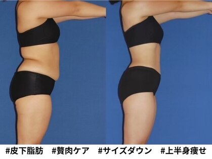 アンシャンテ 芦屋店の写真