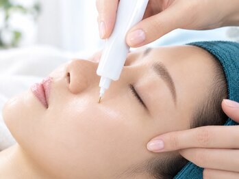 トータルビューティー マインド(Total Beauty)の写真/【結果にコミットするシミケア】長年のお悩みを解消します！！