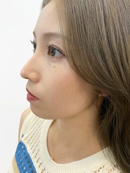 ルディア(Ludear)の写真/☆ご新規様キャンペーン中☆自然なカールからパッチリとしたデザインまでお好みに合わせて施術します◎