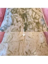 リンダ 西宮店(LINDA)/背面ハーブピーリング