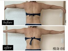 リノ(Lino)の雰囲気（協力痩身マシンで本気の痩身！サイズダウンはお任せください）