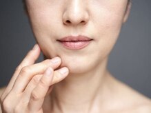 リノア(Linoa)の雰囲気（鏡を見てため息が出る毎日から卒業）