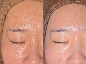 ルーナジェーナ(Luna llena)/