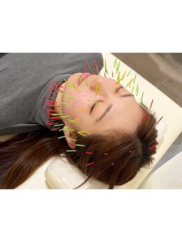 小顔になりたい