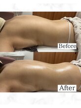 韓国式肌質改善・バストケアサロンKaela【4月 NEW OPEN（予定）】/