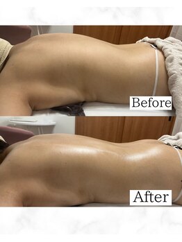 韓国式肌質改善・バストケアサロンKaela【4月 NEW OPEN(予定)】/