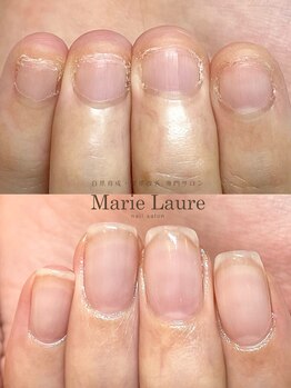 マリーロール 梅田店(Marie Laure)/自爪育成/深爪矯正/ネイルケア