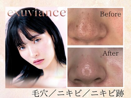 ビューティーサロンリノ 三宮店(Lino)の写真