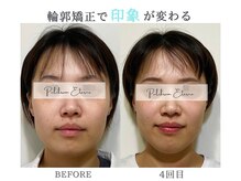 プルチャームエクイデム(Pulchram equidem)/ヘッドスパ+頭蓋骨矯正+小顔矯正