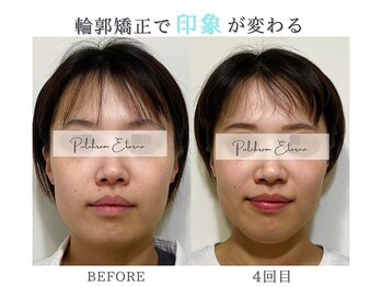 プルチャームエクイデム(Pulchram equidem)/ヘッドスパ+頭蓋骨矯正+小顔矯正