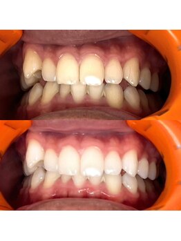 プロテア 藤枝店(PROTEA)/医療提携ホワイトニング