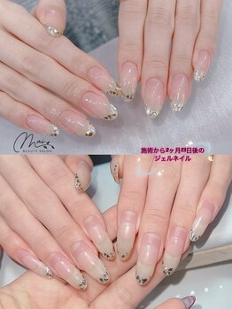 マイ(Mai)/施術から2ヶ月13日後ジェル