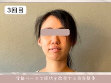 ほぐし屋 かすがい/3回目/小顔リフト＋美姿勢整体