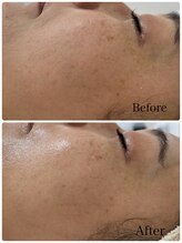 ベルエクラ(Bel Eclat)/乾燥・シミ・シワがお悩み/那覇