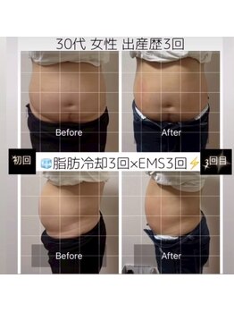 スリム(SLIM by lily of the valley)/夏までに痩せたい！