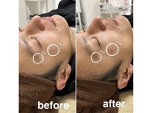 ソルナ ブルーム(SOLUNA BLOOM)/剥がれるシミケアもおすすめ♪