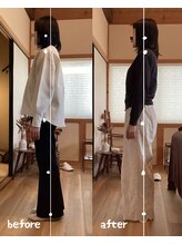 ソウェル(soweru.)/before / after