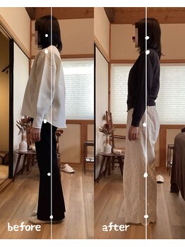 ソウェル(soweru.)/before / after