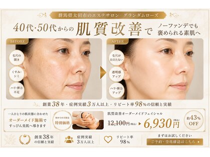 グランダム ローズの写真
