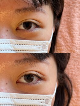 バードアイ(bird eye)/ラッシュリフト