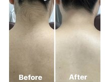 ルル(RuRu)/ Wax脱毛