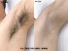 セルフ脱毛【15分打ち放題】時間内ショット無制限！　¥1640