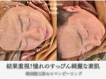 セレブリボーン 大阪ボーテ/肌悩み根本解決セルマンメゾット