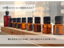 ククナ 新横浜駅前サロン/新横浜駅前/個室施術/小顔専門