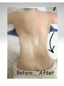 コア(Coeur)/筋膜リリースで背中美人に♪