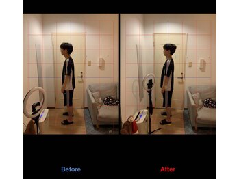 美骨ラボ 自由が丘(美骨Labo)/施術before&after