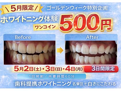 エランホワイトニング 一社店の写真