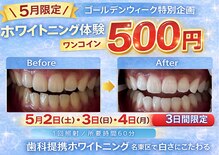 エランホワイトニング 一社店