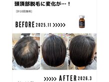 サンシー整体(SunCY整体)/６０代女性