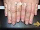 自爪育成★Before