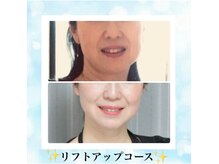 サイエンスビューティー ケイ ティ(K T)の雰囲気（★４Dリフトアップマシーン★1700shot★たるみ改善初回￥6000♪）