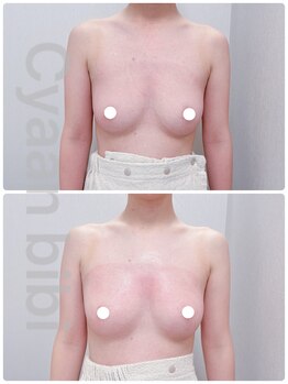 シアンビビ(Cyaan bibi)/