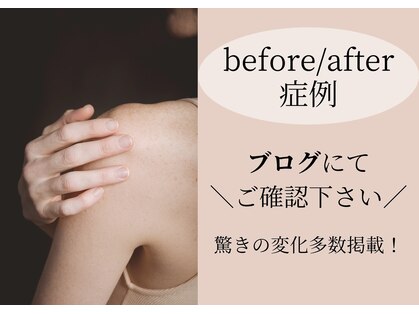 ヨサパーク 美らく 水戸店(YOSA PARK)の写真