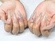 アローナ ネイル(Arona nail)の写真/高技術◇亀裂.折れてしまった爪も安心♪自然な長さだしで理想の美フォルムへ★1本～でもOK!!