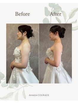 アーマンクラージュ(Ahmen Courage)/ブライダルエステ【赤羽/痩身】