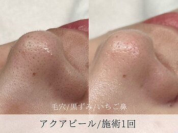 ミューズ バイ エス(MUSE BY S)/