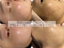 サロン エム(saron M)