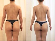 ファニービー 吹田店/20代3ヶ月10kgダイエット成功！