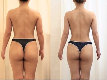 ファニービー 吹田店/20代3ヶ月10kgダイエット成功！