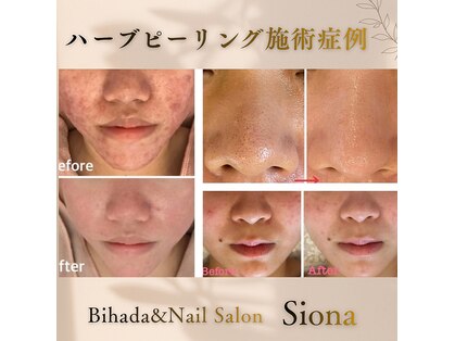 シオナ(Siona)の写真