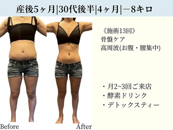 京都フォーエイチ(京都4H)/30代後半|産後5ヶ月|-8キロ