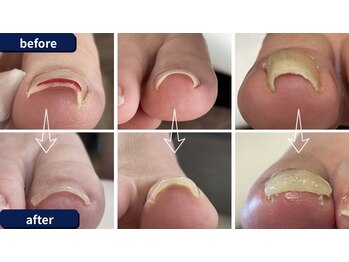 痛みはその場で解消できます!