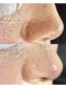 エルナ(elnna)の写真/毛穴の汚れを取り除き、ワントーン明るい透明感のある美肌へ。完全個室で人目を気にせず美しさを追求◎