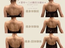 エステティックサロン アールグレー 名古屋駅店/プレ花/たった2回でもこの変化◎