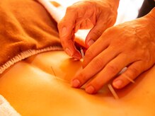 サロンラメール(Salon Lamer)/鍼灸/腰痛の改善に